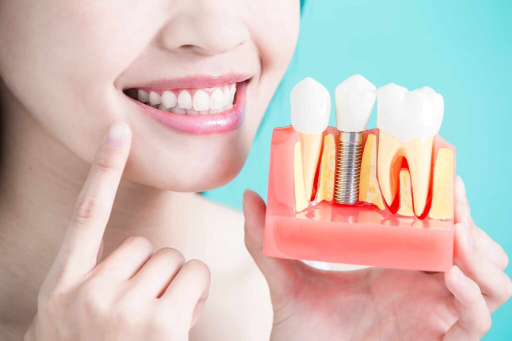 Woman showing dummy model of dental implant procedure in Centreville, VA