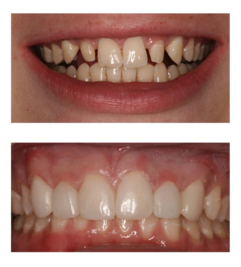 The before & after image of cosmetic dental surgery in Centreville, VA