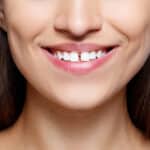 cosmetic dentistry