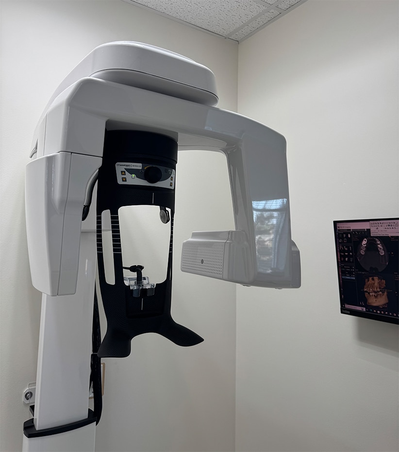 3D-Cone-Beam-CT-Scan-CBCT | Total Dental Arts 3D Cone Beam CT Scan (CBCT)