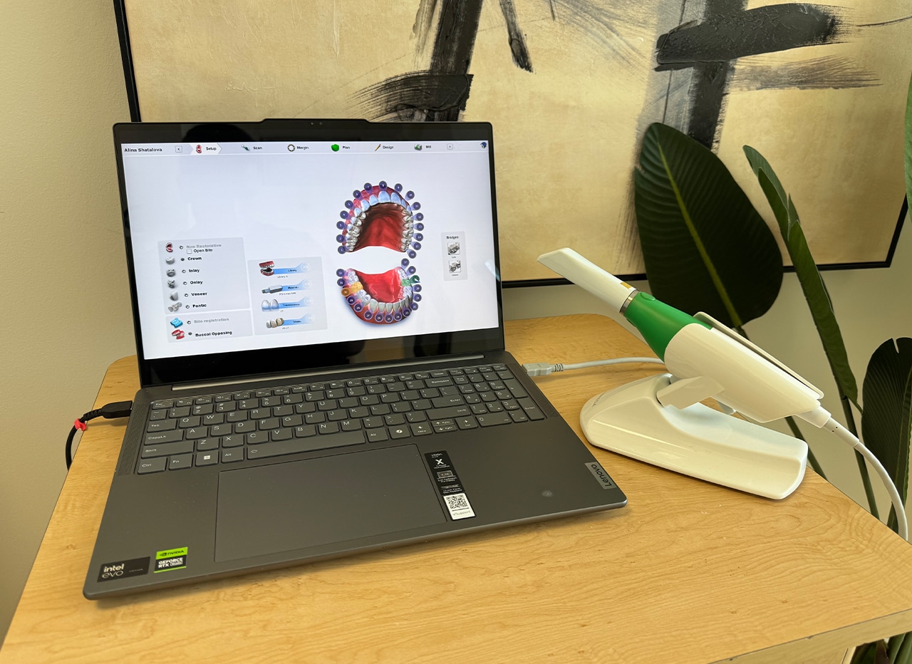 Planmeca-Intraoral-Scanner | Total Dental Arts