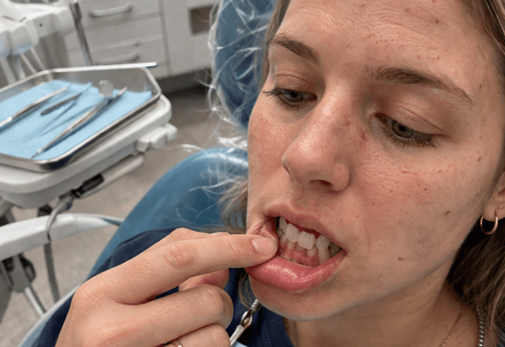 Woman pulling down lower lip to show gums.