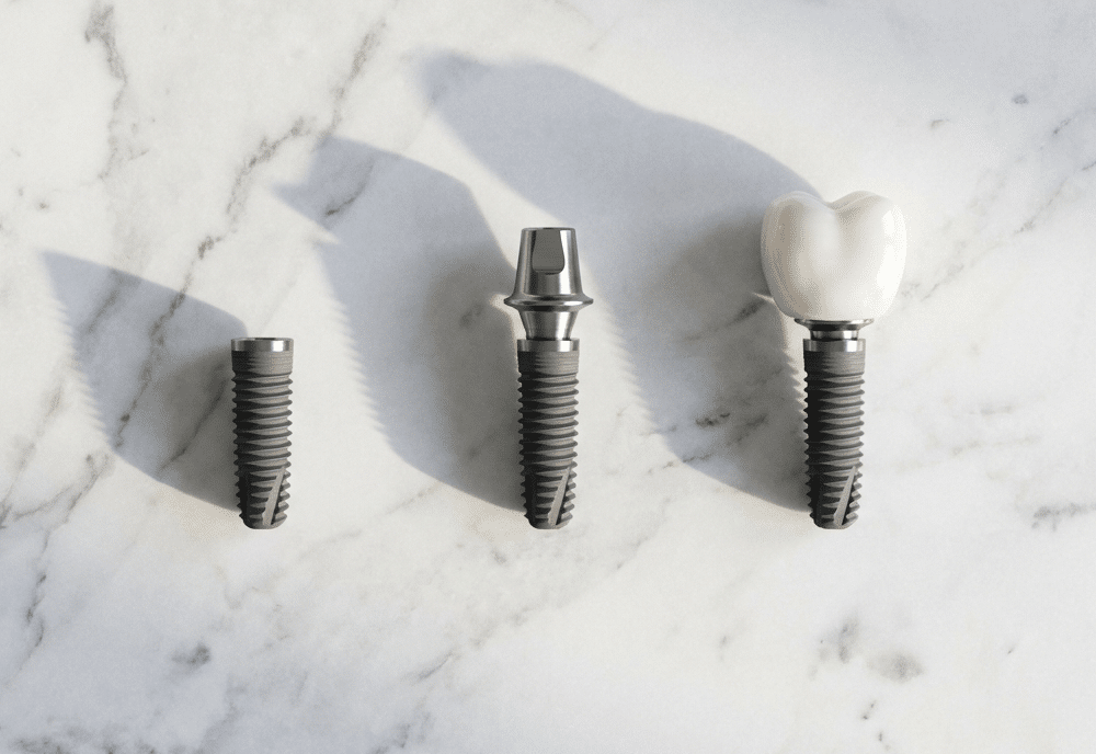 Dental implant components, including a titanium implant post, abutment, and natural-looking dental crown, displayed on a white marble surface.